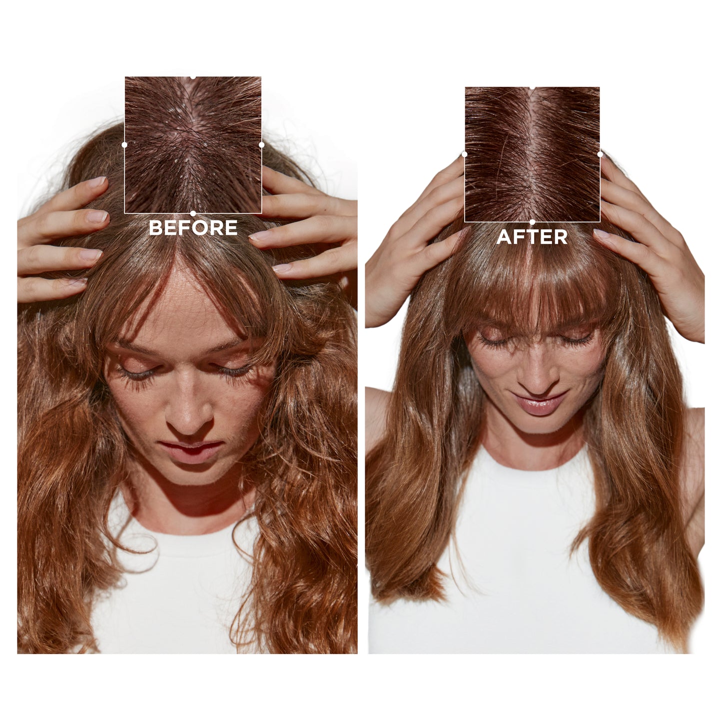 SYMBIOSE INTENSIVE ANTI-DANDRUFF CELLULAR NIGHT SERUM 90ml