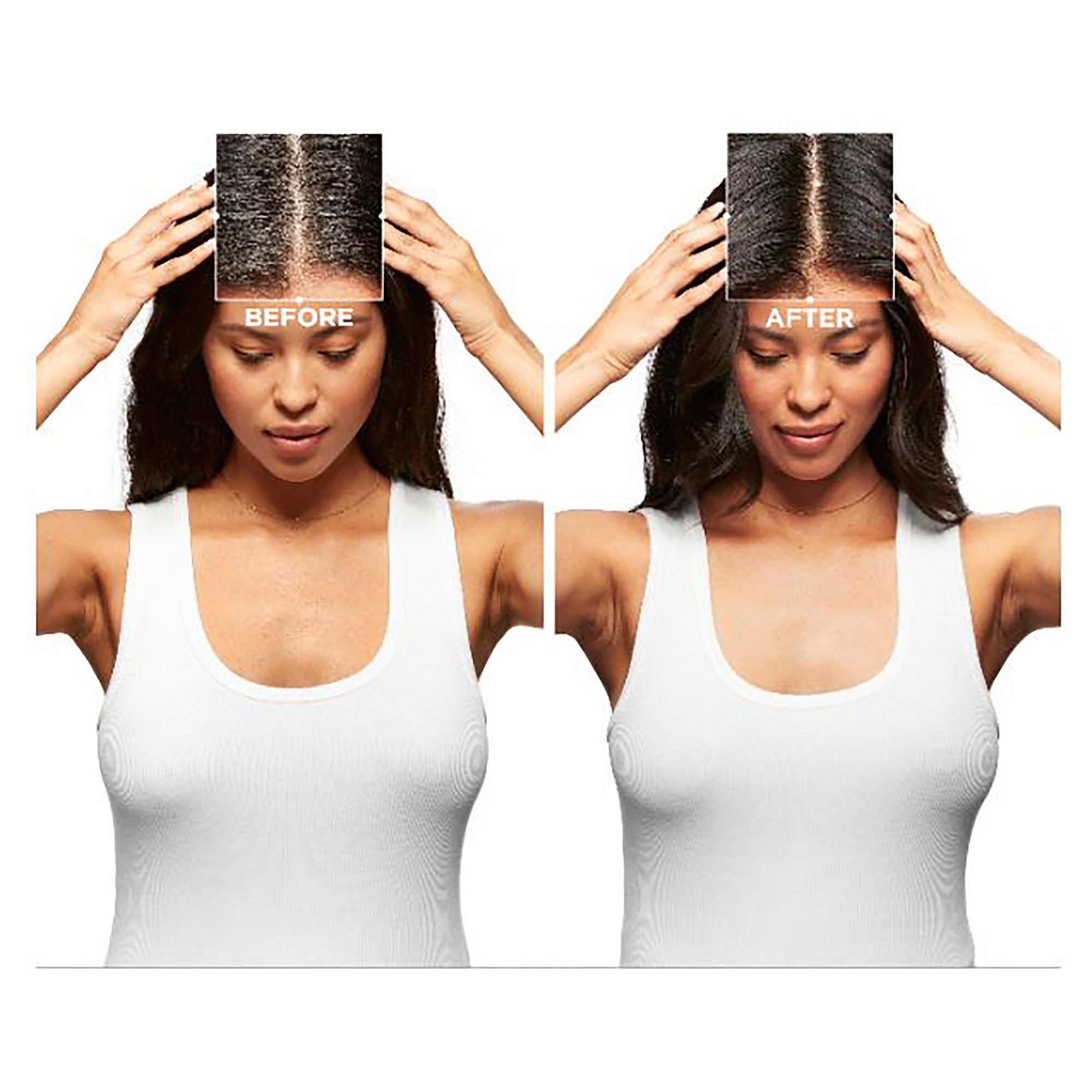 SYMBIOSE CRÉME HYDRATING ANTI-DANDRUFF BAIN 250ml