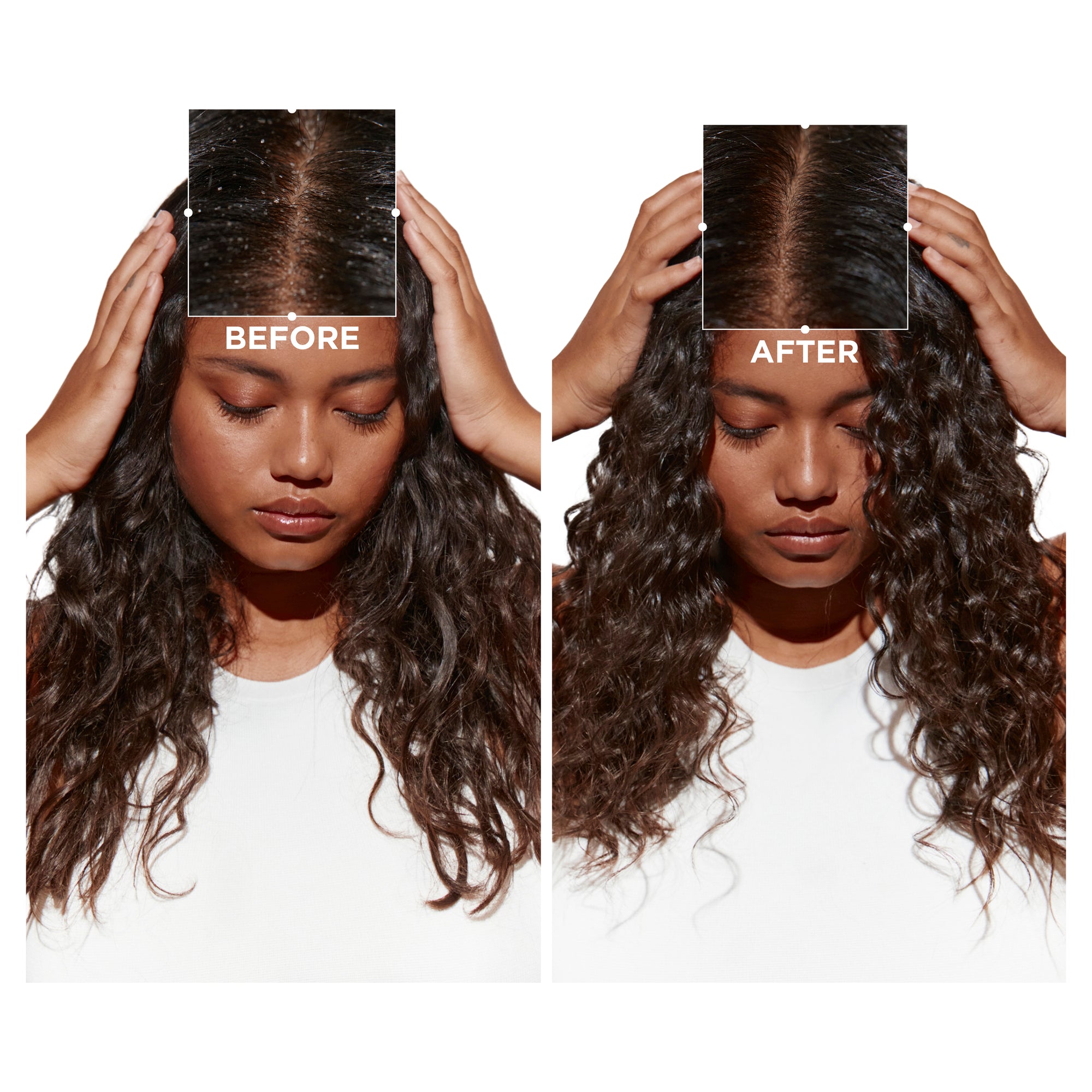 SYMBIOSE PURETÉ ANTI-DANDRUFF BAIN 250ml