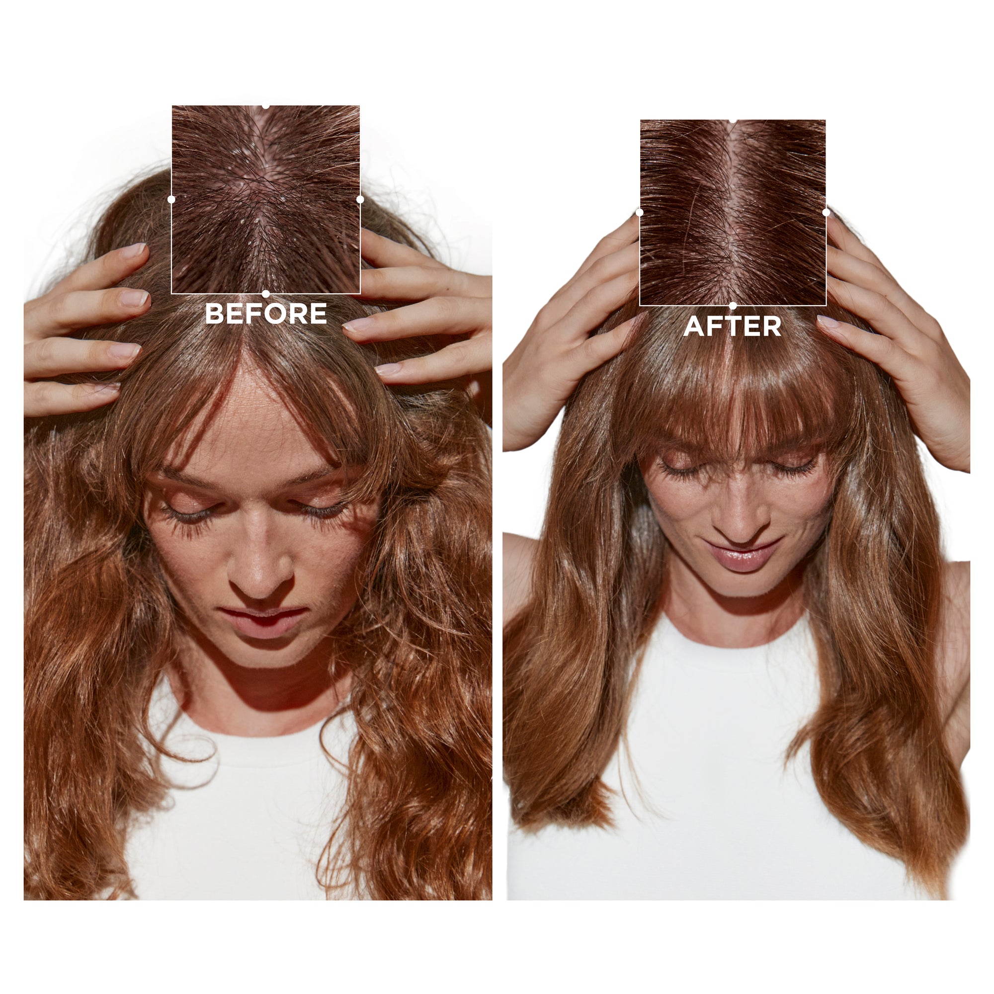 SYMBIOSE INTENSIVE ANTI-DANDRUFF CELLULAR NIGHT SERUM 90ml